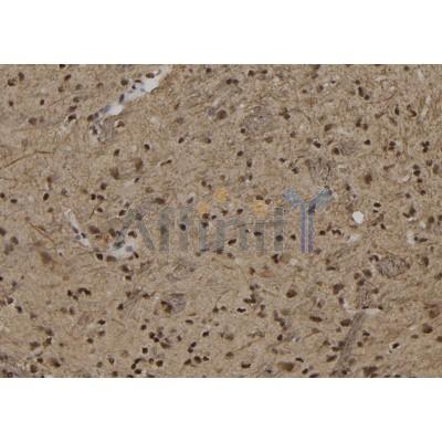 DF9950 at 1/100 staining Rat brain tissue by IHC-P.The sample was formaldehyde fixed and a heat mediated antigen retrieval step in citrate buffer was performed.The sample was then blocked and incubated with the antibody for 1.5 hours at 22C.