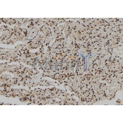AF9028 at 1/100 staining Human lung tissue by IHC-P.The sample was formaldehyde fixed and a heat mediated antigen retrieval step in citrate buffer was performed.The sample was then blocked and incubated with the antibody for 1.5 hours at 22C.