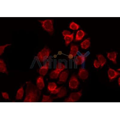 AF3176 staining Hela by IF/ICC.The sample were fixed with PFA and permeabilized in 0.1% Triton X-100,then blocked in 10% serum for 45 minutes at 25C.The primary antibody was diluted at 1/200 and incubated with the sample for 1 hour at 37C.