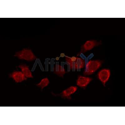 AF3177 staining Hela by IF/ICC.The sample were fixed with PFA and permeabilized in 0.1% Triton X-100,then blocked in 10% serum for 45 minutes at 25C.The primary antibody was diluted at 1/200 and incubated with the sample for 1 hour at 37C.