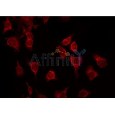 AF3178 staining Hela by IF/ICC.The primary antibody was diluted at 1/200 and incubated with the sample for 1 hour at 37C. An Alexa Fluor 594 conjugated goat anti-rabbit IgG (H+L) Ab, diluted at 1/600, was used as the secondary antibod