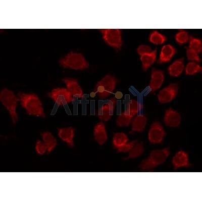 AF3179 staining Hela by IF/ICC.The sample were fixed with PFA and permeabilized in 0.1% Triton X-100,then blocked in 10% serum for 45 minutes at 25C.The primary antibody was diluted at 1/200 and incubated with the sample for 1 hour at 37C.