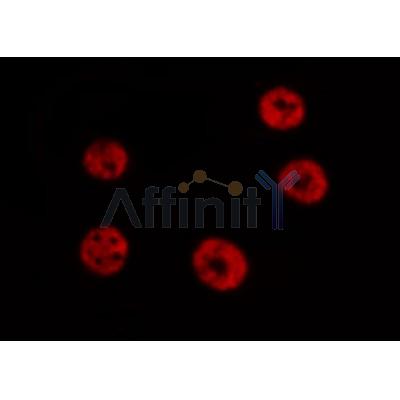 AF3302 staining HeLa by IF/ICC.The sample were fixed with PFA and permeabilized in 0.1% Triton X-100,then blocked in 10% serum for 45 minutes at 25C.The primary antibody was diluted at 1/200 and incubated with the sample for 1 hour at 37C.