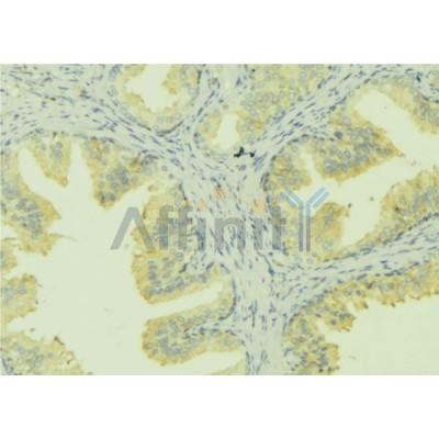 DF12184 at 1/100 staining Mouse colon tissue by IHC-P.The sample was formaldehyde fixed and a heat mediated antigen retrieval step in citrate buffer was performed.The sample was then blocked and incubated with the antibody for 1.5 hours at 22C.