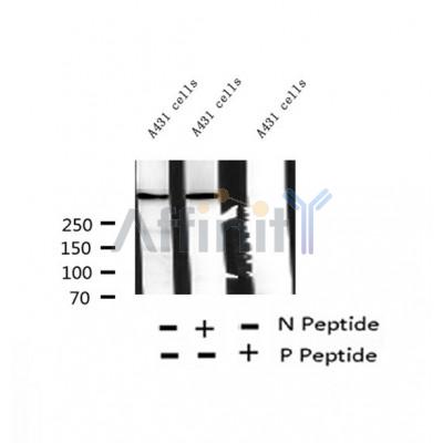Western blot analysis of extracts of A431 cells, using Phospho-RYR2( Ser2814) Antibody.