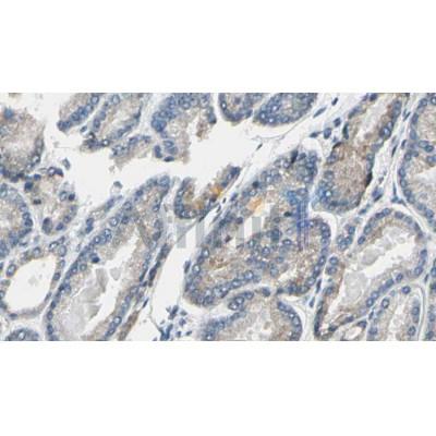 AF6432 at 1/100 staining Human prostate tissue by IHC-P.The sample was formaldehyde fixed and a heat mediated antigen retrieval step in citrate buffer was performed.The sample was then blocked and incubated with the antibody for 1.5 hours at 22C.