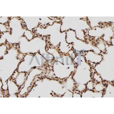 AF6494 at 1/100 staining Rat lung tissue by IHC-P.The sample was formaldehyde fixed and a heat mediated antigen retrieval step in citrate buffer was performed.The sample was then blocked and incubated with the antibody for 1.5 hours at 22C.