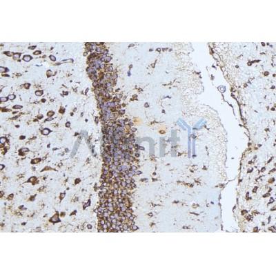 DF3493 at 1/100 staining Mouse brain tissue by IHC-P. The sample was formaldehyde fixed and a heat mediated antigen retrieval step in citrate buffer was performed. The sample was then blocked and incubated with the antibody for 1.5 hours at 22C. 