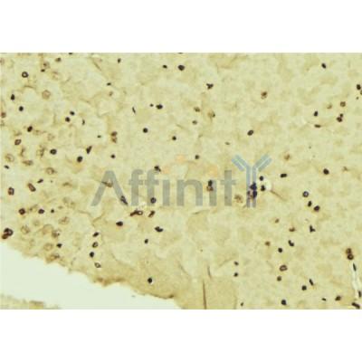 DF6203 at 1/100 staining Mouse brain tissue by IHC-P.The sample was formaldehyde fixed and a heat mediated antigen retrieval step in citrate buffer was performed.The sample was then blocked and incubated with the antibody for 1.5 hours at 22C.