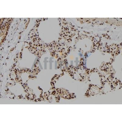 DF6441 at 1/100 staining Rat lung tissue by IHC-P.The sample was formaldehyde fixed and a heat mediated antigen retrieval step in citrate buffer was performed.The sample was then blocked and incubated with the antibody for 1.5 hours at 22C.