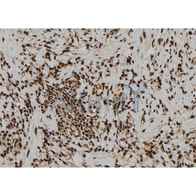 DF6858 at 1/100 staining Human gastric tissue by IHC-P. The sample was formaldehyde fixed and a heat mediated antigen retrieval step in citrate buffer was performed. The sample was then blocked and incubated with the antibody for 1.5 hours at 22C. 