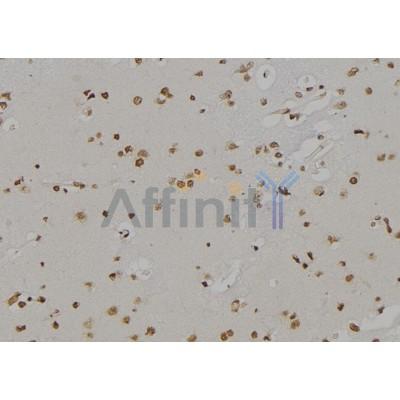 DF6881 at 1/100 staining Human brain tissue by IHC-P.The sample was formaldehyde fixed and a heat mediated antigen retrieval step in citrate buffer was performed.The sample was then blocked and incubated with the antibody for 1.5 hours at 22C.