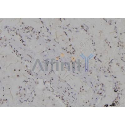 DF6947 at 1/100 staining Human lung tissue by IHC-P. The sample was formaldehyde fixed and a heat mediated antigen retrieval step in citrate buffer was performed. The sample was then blocked and incubated with the antibody for 1.5 hours at 22C. 