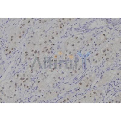 DF7003 at 1/100 staining Human kidney tissue by IHC-P.The sample was formaldehyde fixed and a heat mediated antigen retrieval step in citrate buffer was performed.The sample was then blocked and incubated with the antibody for 1.5 hours at 22C.