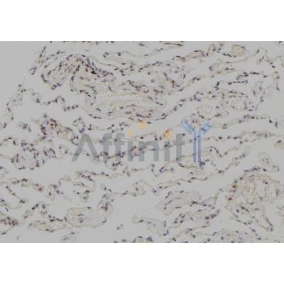 DF7027 at 1/100 staining Human lung tissue by IHC-P.The sample was formaldehyde fixed and a heat mediated antigen retrieval step in citrate buffer was performed.The sample was then blocked and incubated with the antibody for 1.5 hours at 22C.