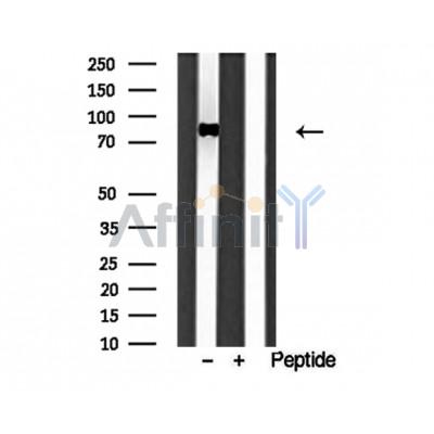 Western blot analysis of extracts of HL-60 cells, using IFT88 antibody.