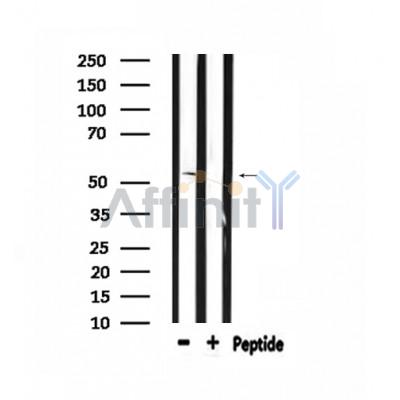 Western blot analysis of extracts from HepG2, using 5-HT-2B Antibody.