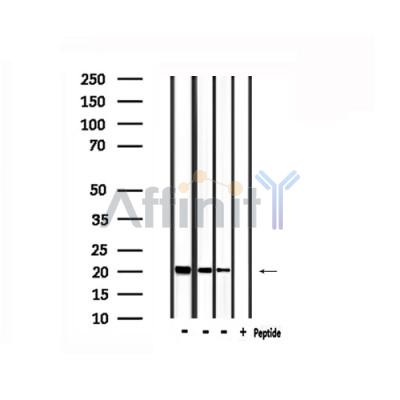 Western blot analysis of extracts from Hela,293 and HUVEC, using FTH1 Antibody.