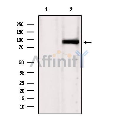 Western blot analysis of extracts from HepG2, using IFT88 antibody. Lane 1 was treated with the blocking peptide.