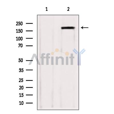 Western blot analysis of extracts from various samples, using ZCCHC11 antibody. Lane 1: hepg2 treated with blocking peptide. Lane 2: Hepg2; Lane 3: B16F10; 