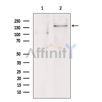 Western blot analysis of extracts from hepg2, using ABCC8 Antibody. Lane 1 was treated with the blocking peptide.