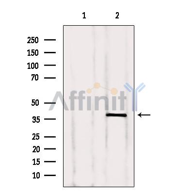 Western blot analysis of extracts from 293, using c-Jun Antibody. Lane 1 was treated with the blocking peptide.