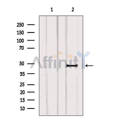 Western blot analysis of extracts from 3t3, using ARL13B Antibody. Lane 1 was treated with the blocking peptide.