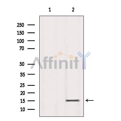 Western blot analysis of extracts from Mouse Spleen, using Histone H3K79me3 Antibody. Lane 1 was treated with the blocking peptide.