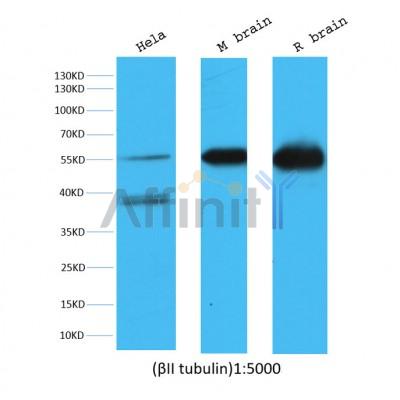 Western blot analysis of extracts from various samples, using Beta II tubulin mouse monoclonal antibody.