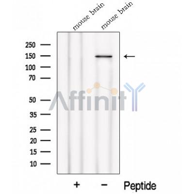 Western blot analysis of extracts from Mouse brain tissue, using NPHP4 Antibody. The lane on the left was treated with blocking peptide.