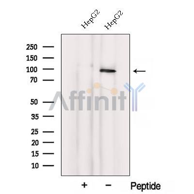 Western blot analysis of extracts from HepG2 cells, using VPS41 Antibody. The lane on the left was treated with blocking peptide.