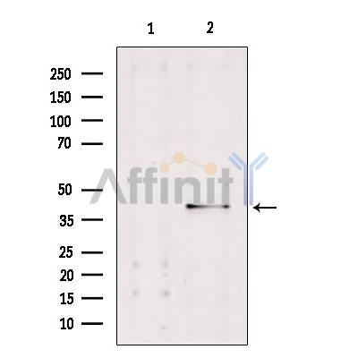 Western blot analysis of extracts from rat muscle, using Caspase 7 Antibody. The lane on the left was treated with antigen-specific peptide.
