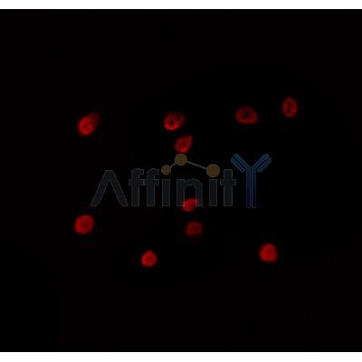 AF0464 staining HepG2 by IF/ICC.The sample were fixed with PFA and permeabilized in 0.1% Triton X-100,then blocked in 10% serum for 45 minutes at 25C.The primary antibody was diluted at 1/200 and incubated with the sample for 1 hour at 37C.