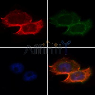 AF5156 staining Hela by IF/ICC.
