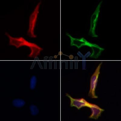 AF0097 staining Hela by IF/ICC.
