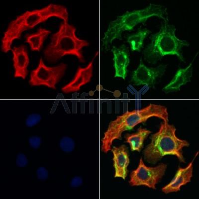 AF0195 staining Hela by IF/ICC.