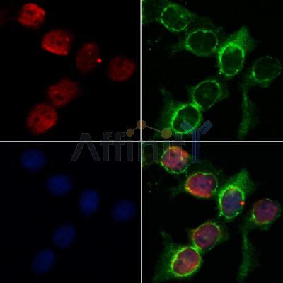 AF5390 staining HepG2 by IF/ICC.