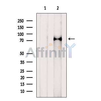 Western blot analysis of extracts from 293, using MEPCE Antibody. The lane on the left was treated with blocking peptide.