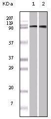 EphA1 Antibody - Figure 1: Western blot analysis using EphA1 mouse mAb against A549 (1) and Hela (2) cell lysate.