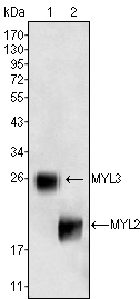 MLC2 Antibody - Western blot analysis using MYL3 (1) and MYL2 (2) mouse mAb against rat fetal heart tissue lysate.