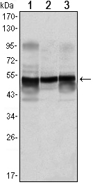 GFAP Antibody - Western blot analysis using GFAP mouse mAb against rat spinal cord(1), rat brain(2), mouse brain(3) lysates.
