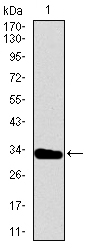 T Antibody - Figure 1: Western blot analysis using T mAb against human T recombinant protein.