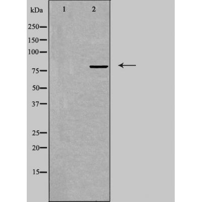 TRIM3 Antibody - Western blot analysis of extracts from COLO cells, using TRIM3 antibody.