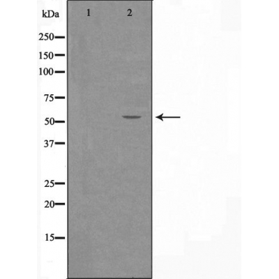 ZNF682 Antibody - Western blot analysis of extracts from COLO205 cells using ZNF682 antibody.