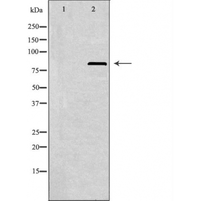 K6PL Antibody - Western blot analysis of extracts from A549 cells using K6PL antibody.