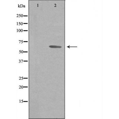 TF2H2 Antibody - Western blot analysis of extracts from COLO205 cells, using TF2H2 antibody.