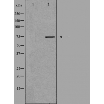 FAKD3 Antibody - Western blot analysis of extracts from HepG2 cells, using FAKD3 antibody.