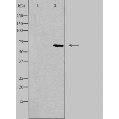 TRIP4 Antibody - Western blot analysis of extracts from K562 cells, using TRIP4 antibody.