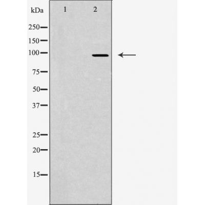 JAKMIP2 Antibody - Western blot analysis of extracts from LOVO cells using JKIP2 antibody.