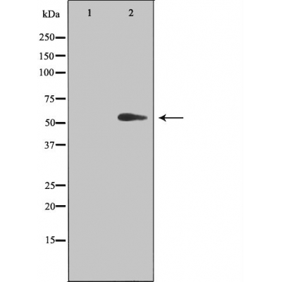 TINF2 Antibody - Western blot analysis of extracts from HUVEC cells, using TINF2 antibody.